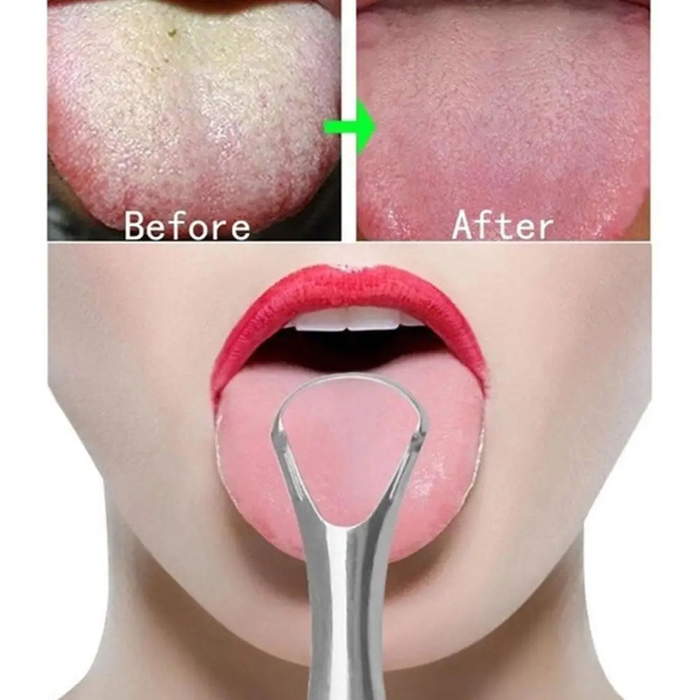 Stainless Steel Tongue Scraper Reusable Oral Hygiene Cleaner